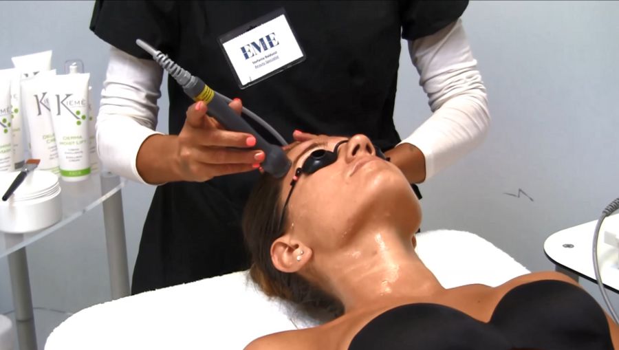 Beauty Laser für Antiaging