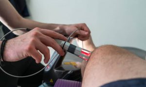 Lasertherapie Anwendungen