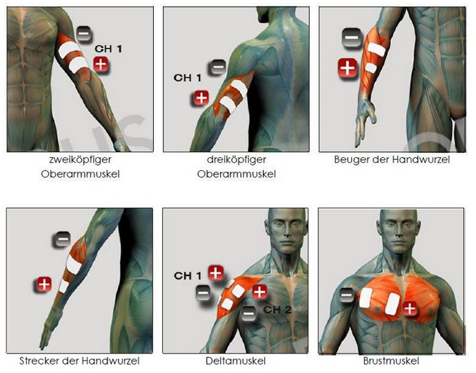 EMS Elektroden Positionen
