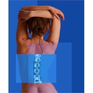 Vibrationstraining bei Osteoporose
