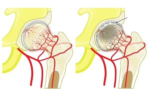 Behandlungsprotokolle der Magnetoenergy-Geräte: Orthopädie