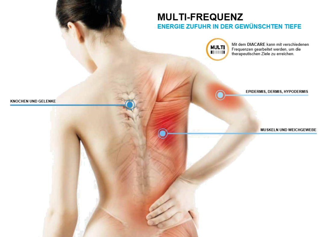 Multifrequenz Tecartherapie